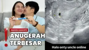 Amanda Manopo Umumkan Hamil Anak Pertama dengan Kenny Austin